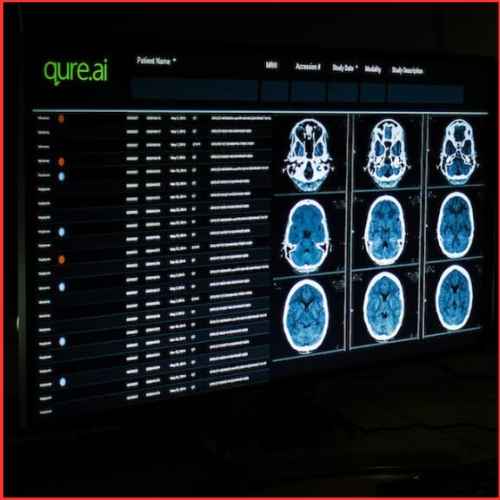 Healthcare AI startup Qure.ai plans to go public within two years, CEO says.-thumnail